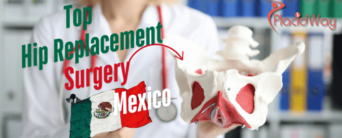 Why Mexico is a Top Destination for Hip Replacement Surgery?